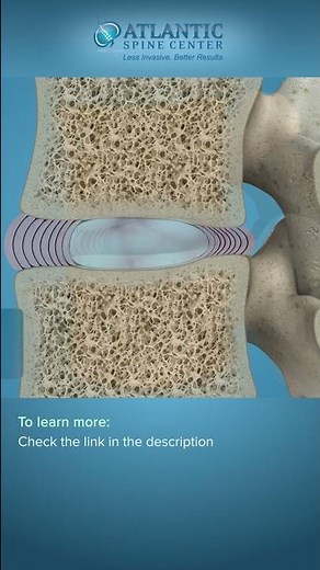 Spine Anatomy | Know Your Spine #Shorts