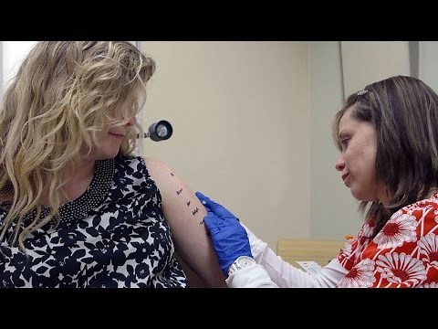 Intradermal Allergy Testing (IDT) Demonstration | MU Health