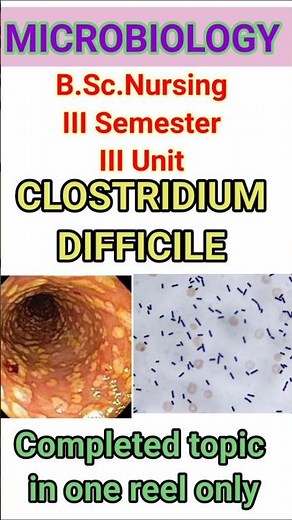 Clostridium Difficile introduction characteristics morphology pathogenesis clinical manifestations.