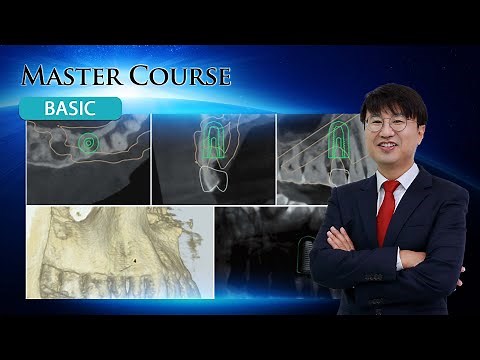 [Master Course - BASIC] ABT Level vs. Implant Level Impression PART 1