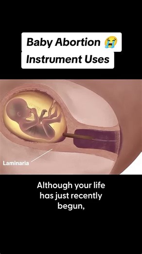 Instrument Uses in Surgical Procedures: A Deep Dive