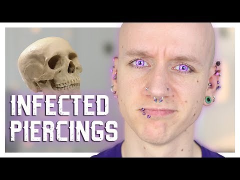 Treating Your Infected Nose Piercing at Home (and When to See a Doctor)
