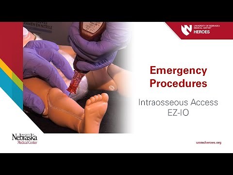 Emergency Procedures: Intraosseous Access - EZ-IO