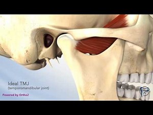 TMJ Clicking