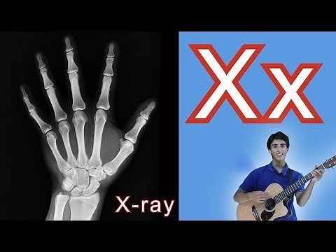 Letter X Song | Letter of the Day | ABC Phonics Song For Kids