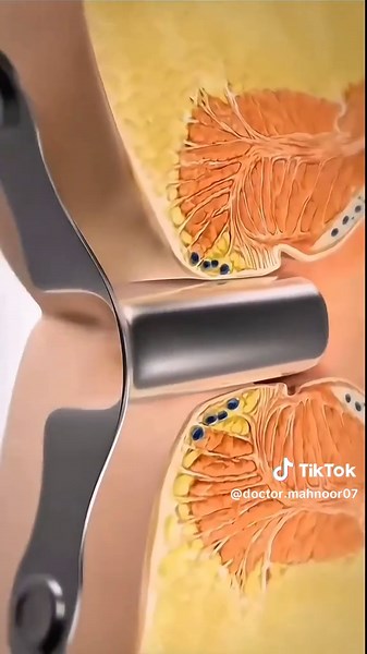 #fyp #capcut #foryoupage | CapCut