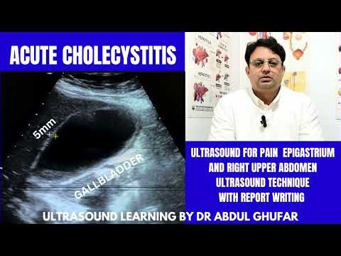 Acute Cholecystitis | cholecystitis ultrasound |Gallbladder ultrasound | gallstones | cholelithiasis