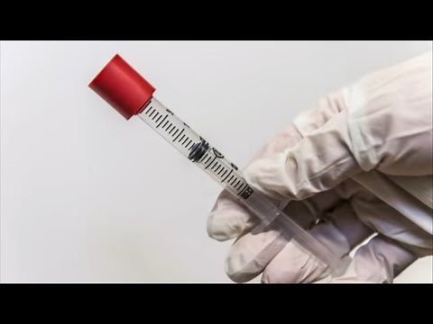 How to Give Subcutaneous Chemotherapy Injections