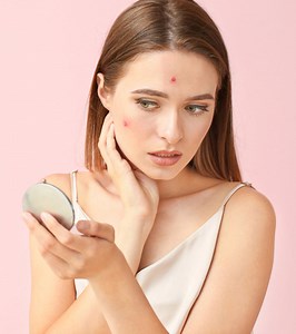 What Is Cephalexin? Can It Treat Acne?