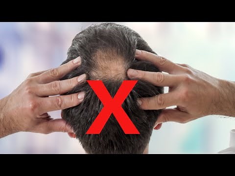 Why scalp massages do NOT stop hair loss