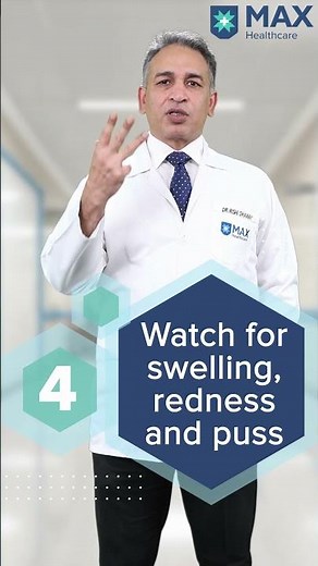 5 tips to treat Skin Ulcers at home | Max Hospital