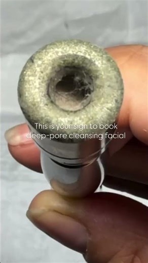 This is your sign to book a deep pore-cleansing facial!