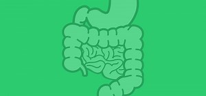 Colorectal Cancer - Oxford Medical Education