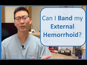 EXTERNAL Hemorrhoid Rubber Banding?