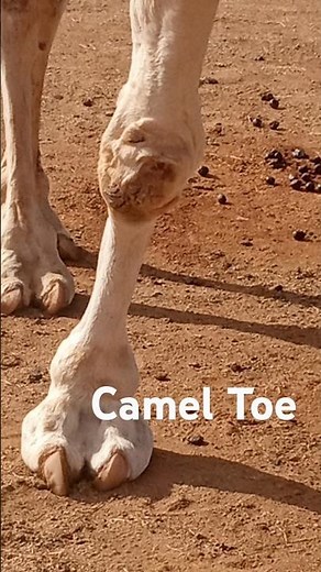 The truth about Camel Toes.