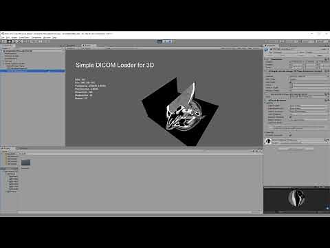 Simple DICOM Loader for Unity