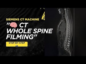 CT Whole Spine Filming | Step-by-Step Protocol for Beginners 🧠📸