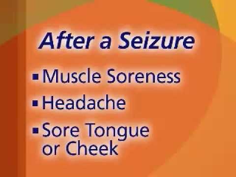 After the Seizure