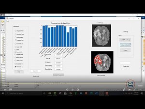 Brain tumor detection using different machine learning algorithm using MATLAB | MATLAB solutions