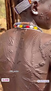 Scarification has played a significant role in the cultures of several communities throughout Africa. . . Scarification is the practice of making superficial incisions on the skin with the use of objects like knives, stones, or glass to carve out images, words, or designs. . A location in South Sudan. 🎥 (@lili yanko) #scar #SouthSudan #iloveafrica | I Love Africa