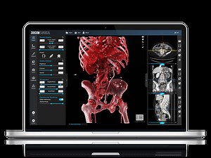 3DICOM MD - 3DICOM Viewer