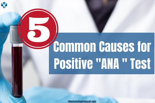 5 common causes for a positive ANA Test
