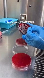 1.4K views · 1K reactions | CAMP test is used to distinguish the...