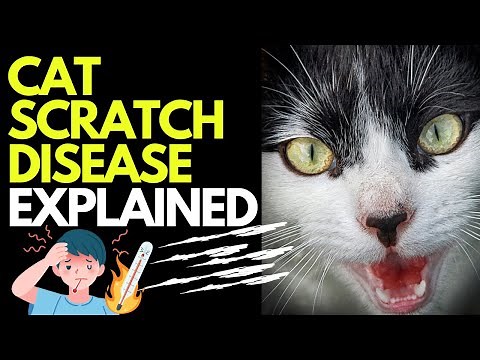 Doctor explains CAT SCRATCH FEVER disease | Causes, symptoms and treatment