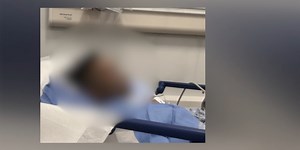 Boy badly burned when children poured boiling water on him during sleepover