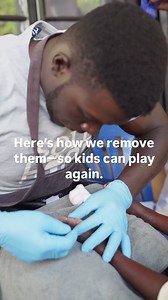 1.4K views · 685 reactions | It’s not like chiggers ⬇️ Jiggers is a...