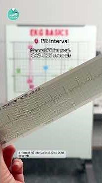 EKG Basics: Part 2 🫀⚡
