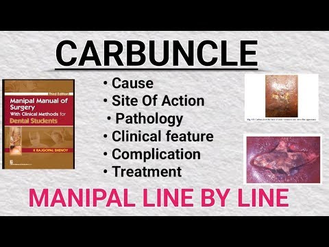 ||CARBUNCLE - SURGERY || Carbuncle Infection: Signs, Causes, Diagnosis & Management