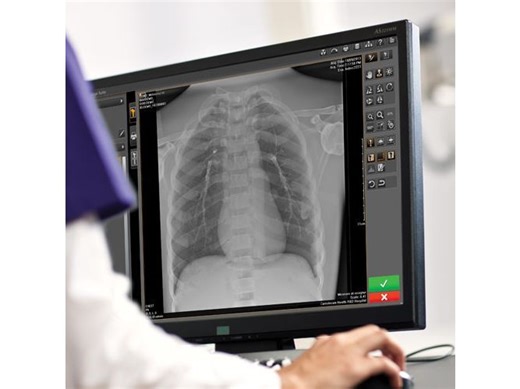 Carestream Introduces New Software Update to Boost Diagnostic Accuracy