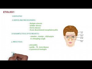 OPTIC NEURITIS LECTURE | NEET PG |