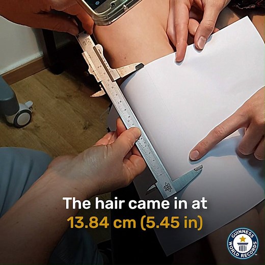 141K views · 58 shares | Ever grown a super-long hair on your body? Dekel's impressive 13.84 cm (5.45 in) leg hair just kept on growing  | Guinness World Records | Facebook