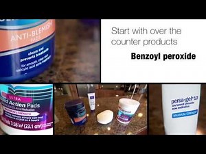 Adult Acne - Mayo Clinic