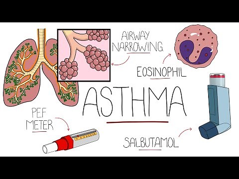 Asthma Explained (Including Pathophysiology)