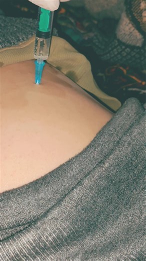 intramuscular injection into the buttocks muscle