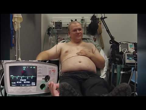 Transcutaneous Pacing Demonstration