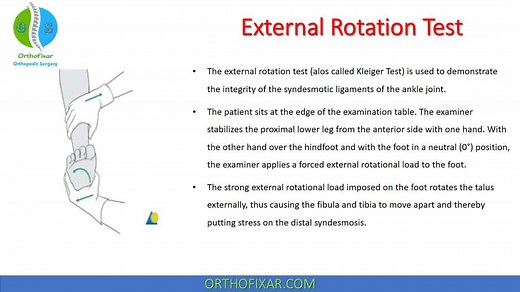 Ankle External Rotation Test | Kleiger Test