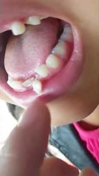 Lose tooth pulling out before school