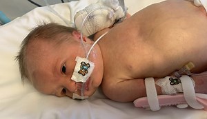 Viral Meningitis - Symptoms, Causes & Treatment