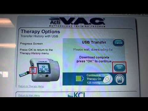 KCI Wound Vac Video
