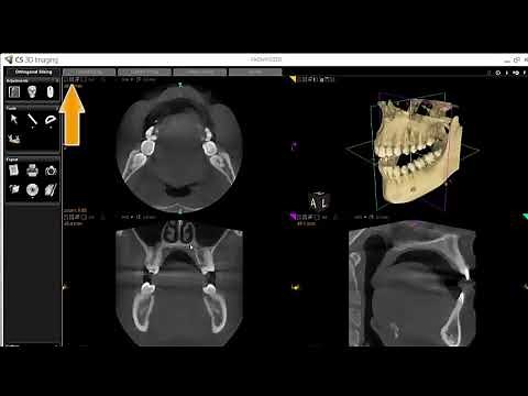 CS 3D imaging software basic tutorial #Carestream