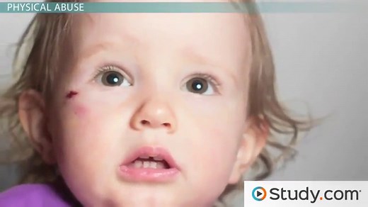 Child Abuse & Neglect | Overview, Types & Examples