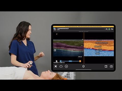 Clarius T-Mode™ for Breast