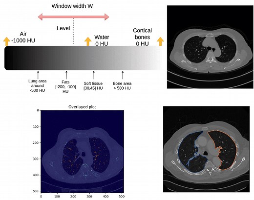 Introduction to medical image processing with Python: CT lung and vessel segmentation without labels | AI Summer