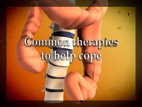 Colon Hydrotherapy Explained