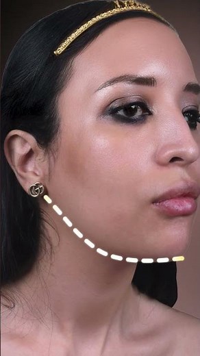 Jawline Contouring Before & After | Jawline Transformation in Istanbul with Natural Clinic