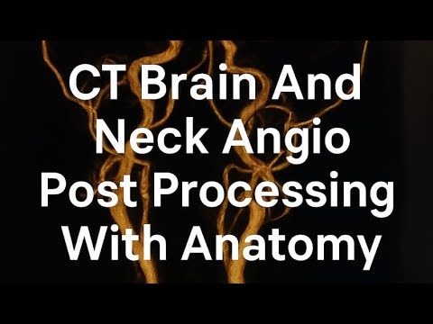 CT Brain & Neck Angio -Post Processing + Full Anatomy Explained, Radiology Tutorial